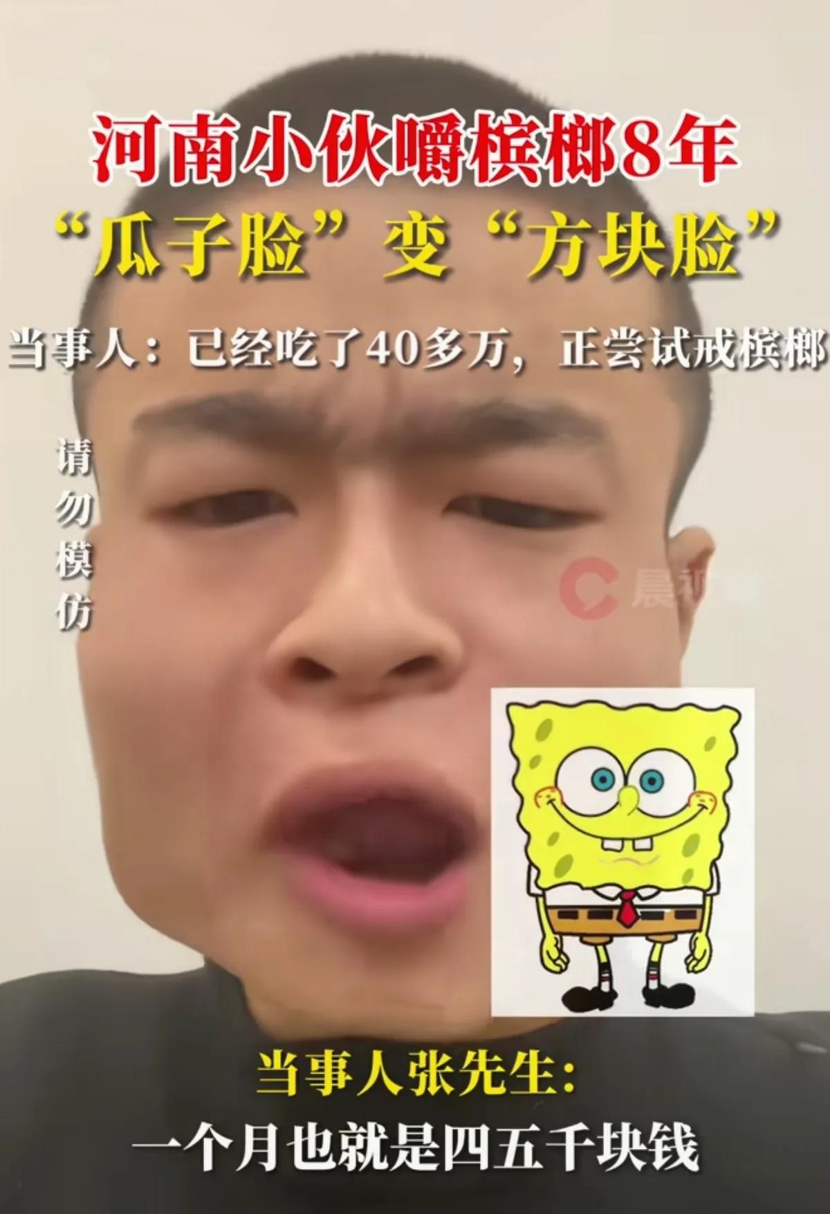 小伙嚼檳榔8年瓜子臉變方塊臉